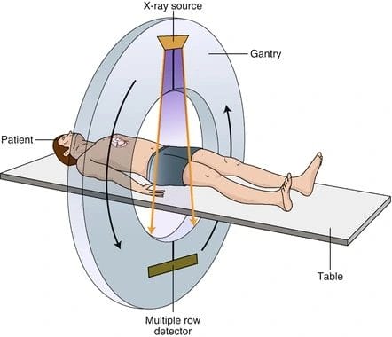 A Complete Guide to Understanding the Principles CT Scans