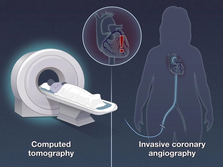 A Complete Guide to Understanding the Principles CT Scans