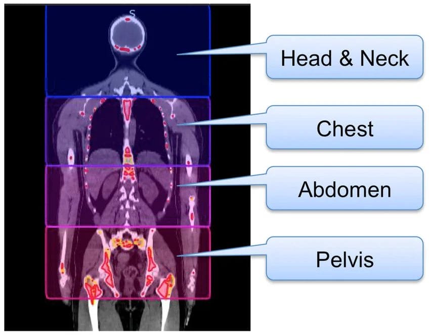 A Complete Guide to Understanding the Principles CT Scans