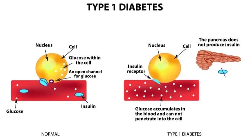 Essential Guide for Living Well with Diabetes