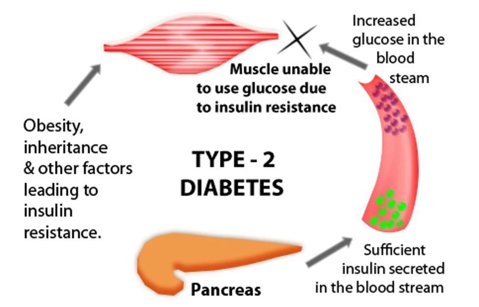 Essential Guide for Living Well with Diabetes