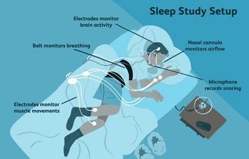 Everything You Need to Know About Sleep Medicine