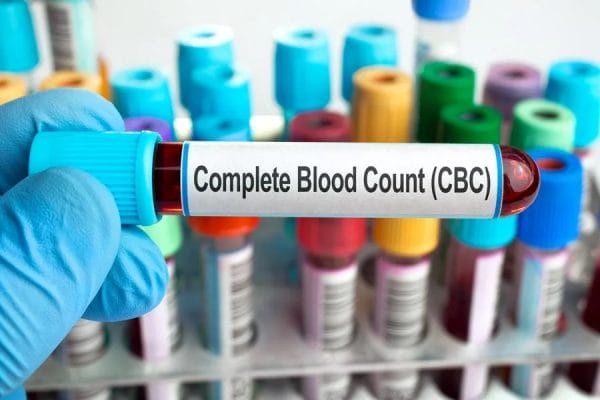 The Importance of Complete Blood Count (CBC) Analysis at Houston Family Physicians PA