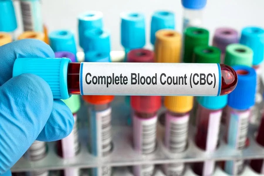 The Importance of Complete Blood Count (CBC) Analysis at Houston Family Physicians PA