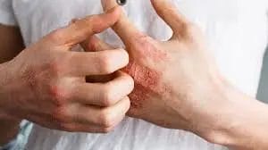 The vital functions and importance of skin