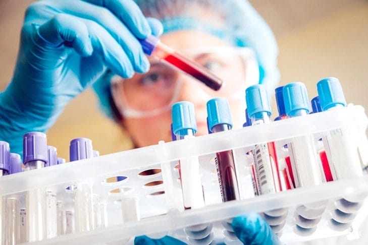 Everything You Need to Know About Laboratory Tests for Better Health