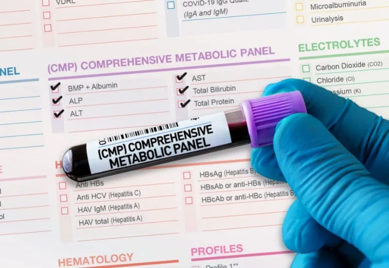 Everything You Need to Know About Laboratory Tests for Better Health