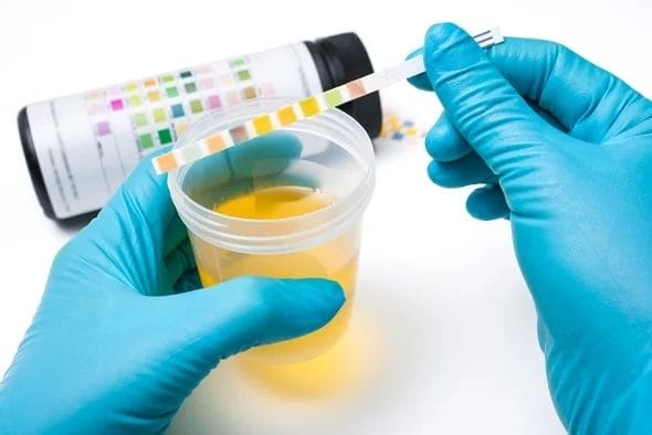 Everything You Need to Know About Laboratory Tests for Better Health