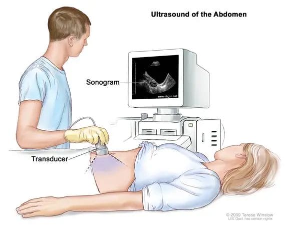 Understanding the Benefits of Ultrasounds