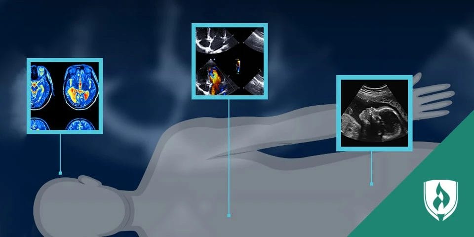 Understanding the Types of Diagnostic Imaging