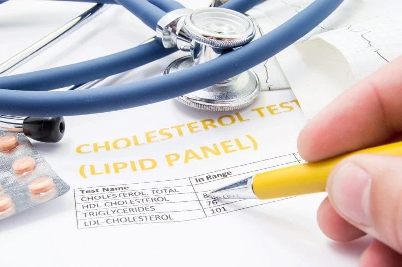 High Cholesterol and Triglycerides