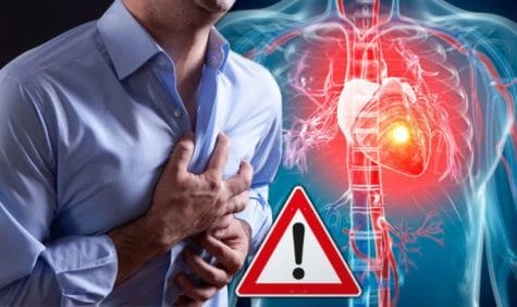 Never Ignore Chest Pain